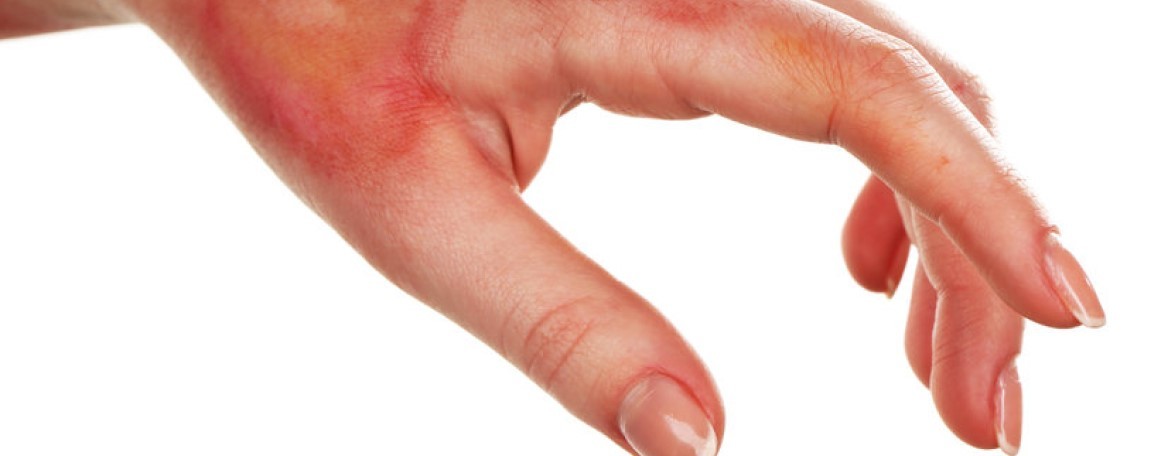 Co to jest rana i jakie są etapy gojenia? Choroby zaburzające gojenie rany.